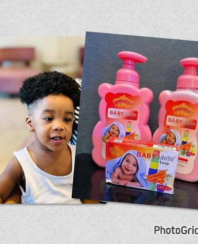 Dépigmentation des nouveau-nés : Une atteinte à l’intégrité et à l’avenir des enfants